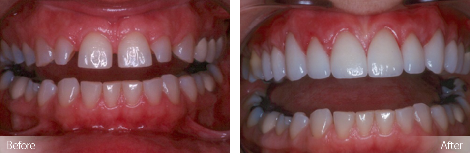متخصص زیبایی دندان در کرج