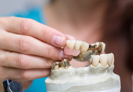پروتز متحرک دندان